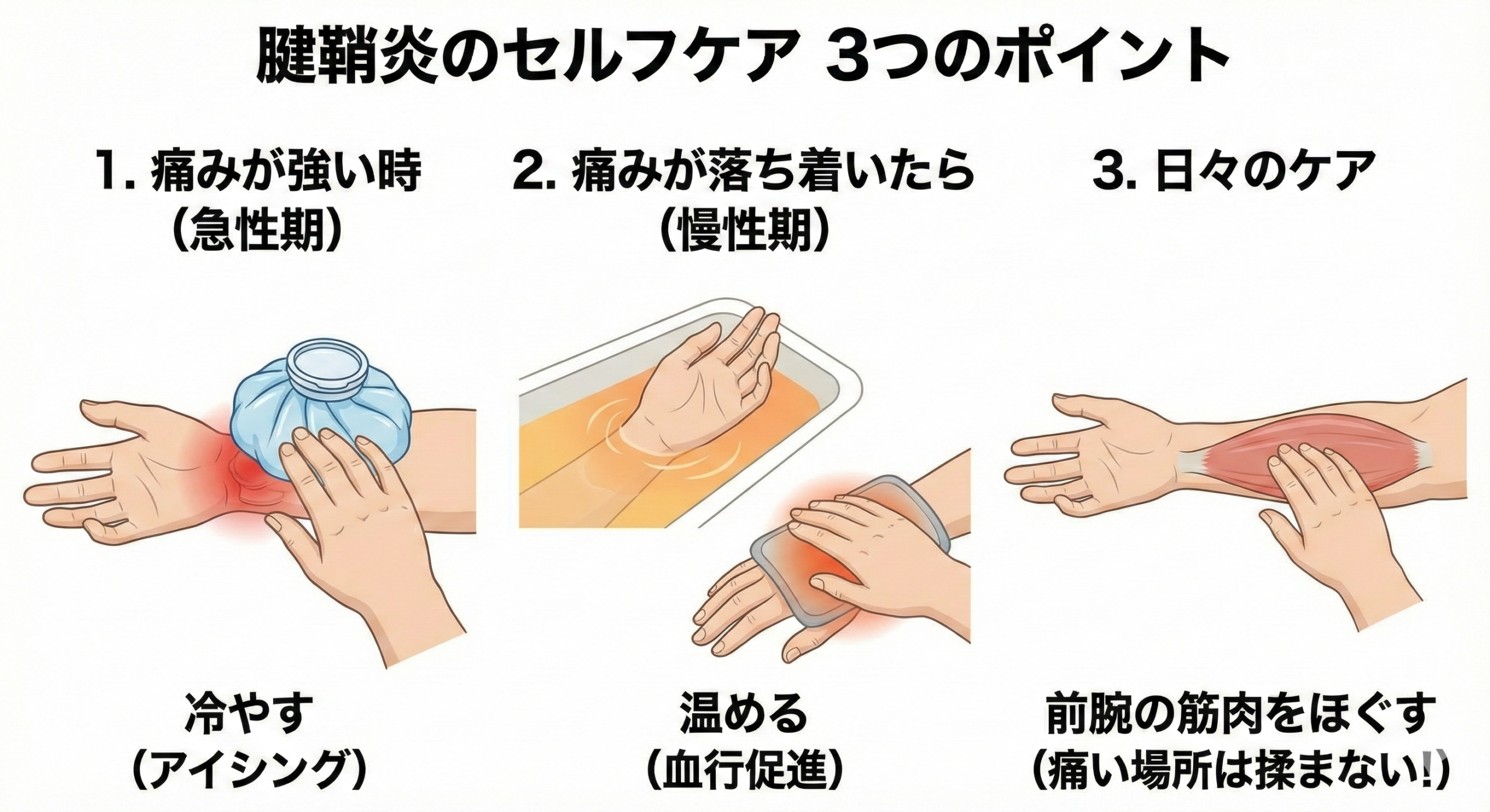 【解剖学で解説】手首が痛い!腱鞘炎の正体と、今日からできるセルフケア